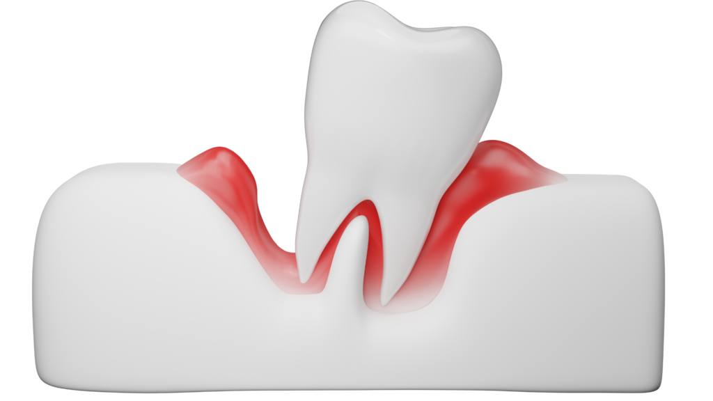 oral microbiome gum disease